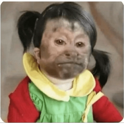 Figurinha: Criança com cara de macaco