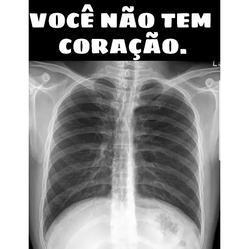 Figurinha: Raio-X: Você não tem coração