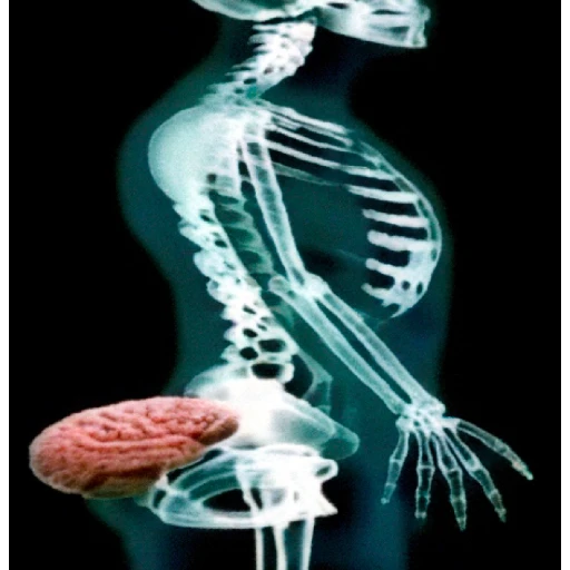 Figurinha: Cérebro Humano em Raio-X