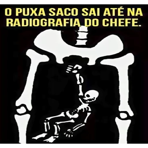 Figurinha: Puxa saco na radiografia do chefe