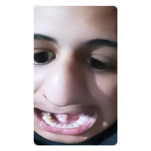 Figurinha: Rosto distorcido